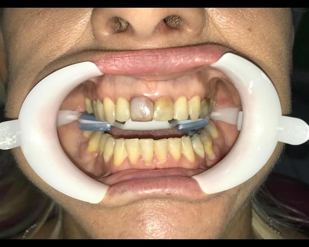 ER Odontologia